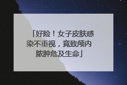 好险！女子皮肤感染不重视，竟致颅内脓肿危及生命